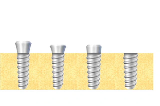 custom titanium dental implant